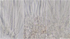 Tryblidiopsis magnesii