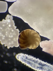 Foraminifera