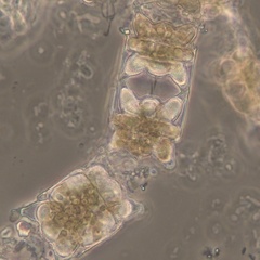 Odontella aurita