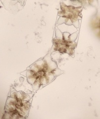Odontella aurita