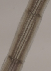 Vertebrata fucoides