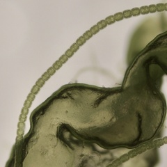 Urospora