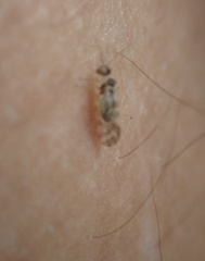 Graphopsocus cruciatus