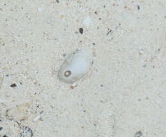 Diodora