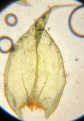 Antitrichia curtipendula