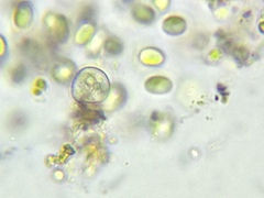 Coccomyxa