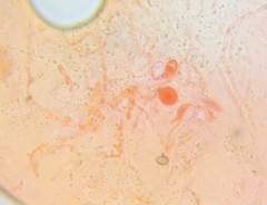 Ditangium cerasi