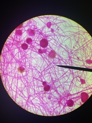 Rhizopus stolonifer