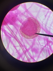 Rhizopus stolonifer