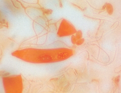 Pezicula ocellata