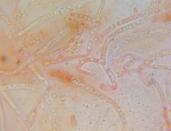 Pezicula ocellata