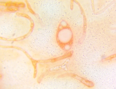 Pezicula ocellata