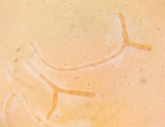 Pezicula ocellata