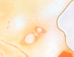Pezicula ocellata