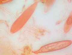 Pezicula ocellata