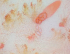 Pezicula ocellata