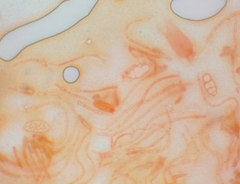 Pezicula ocellata