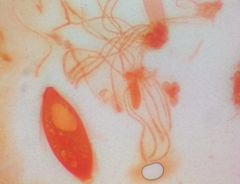 Pezicula ocellata