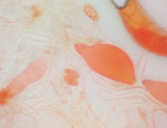 Pezicula ocellata