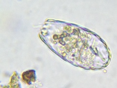Euglypha