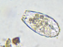 Euglypha