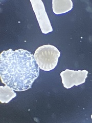 Foraminifera