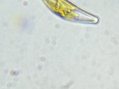 Cymbella