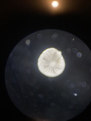 Elphidium crispum