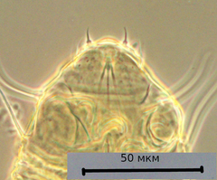 Echiniscus