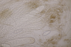 Pseudombrophila hepatica