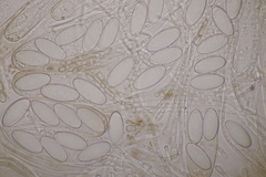 Pseudombrophila hepatica