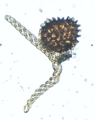 Fossombronia pusilla