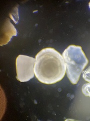 Foraminifera