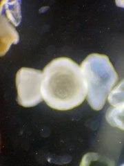 Foraminifera