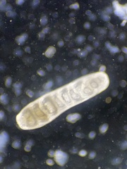 Siphogenerina