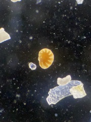 Foraminifera
