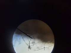 Botrytis