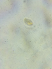 Cortinarius armeniacus