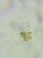 Cortinarius armeniacus