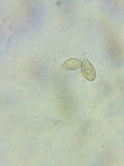 Cortinarius armeniacus