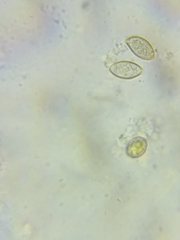 Cortinarius armeniacus