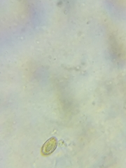 Cortinarius armeniacus