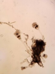 Entoprocta
