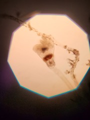 Entoprocta