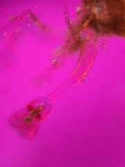 Entoprocta