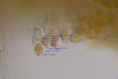 Puccinia lapsanae