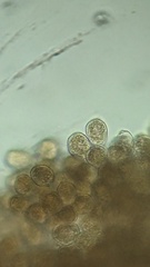 Puccinia lapsanae