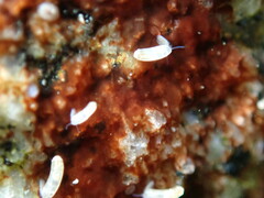 Caecum