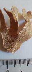 Bryozoa