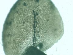 Frullania tamarisci